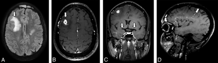 FIG 1.