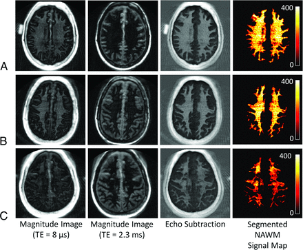 FIG 3.