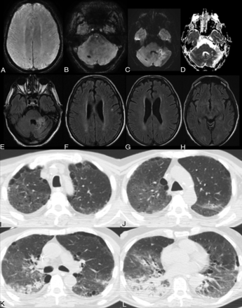 FIG 4.