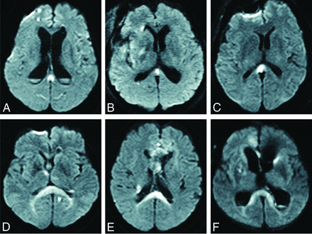 FIG 1.