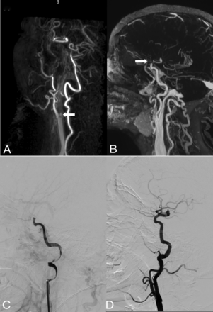 FIG 2.