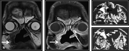 FIG 1.
