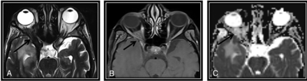 FIG 2.