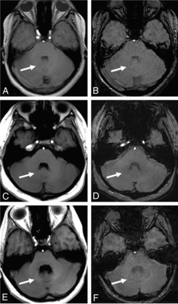FIG 4.