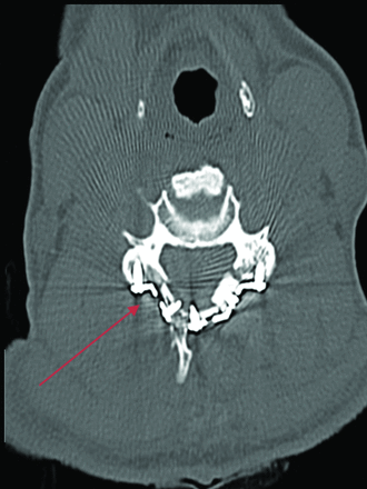 FIG 10.