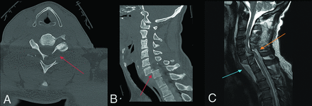 FIG 4.