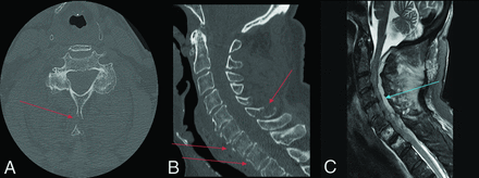 FIG 5.