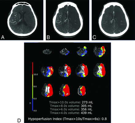 FIG 3.