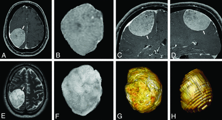 FIG 4.