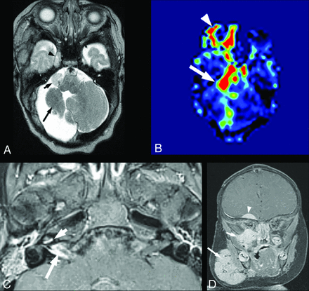 FIG 2.