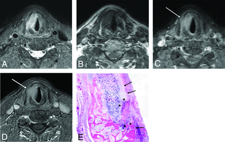 FIG 2.