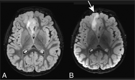 FIG 2.