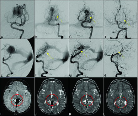 FIG 2.