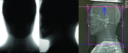 FIG 3.
