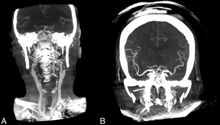 FIG 4.