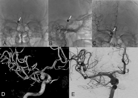 FIG 3.