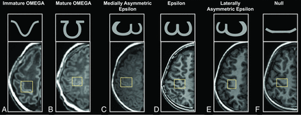 FIG 1.