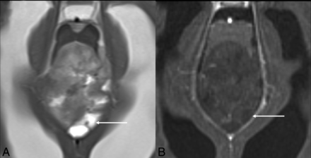 FIG 1.