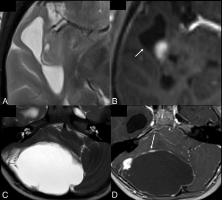 FIG 3.
