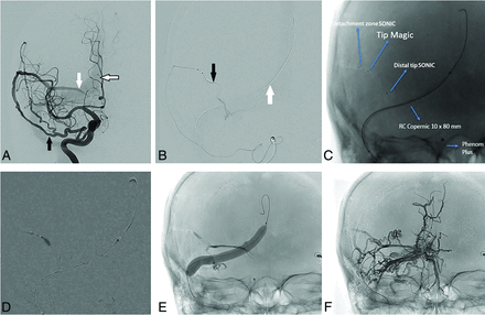 FIG 1.