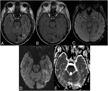 FIG 1.