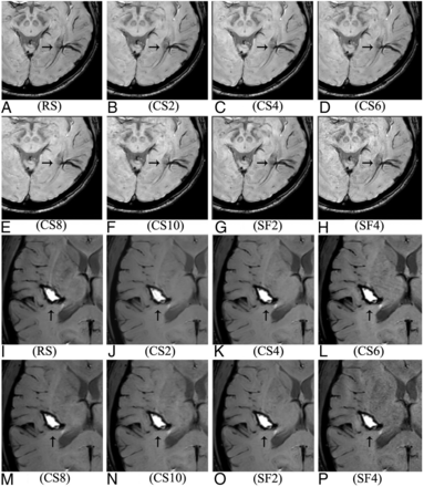 FIG 4.
