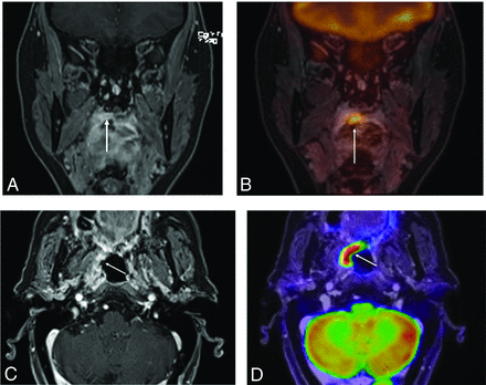 FIG 2.