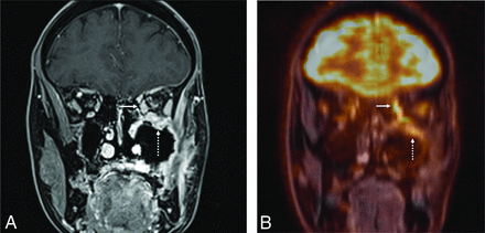 FIG 3.