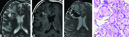 FIG 3.