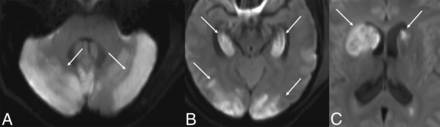 FIG 4.