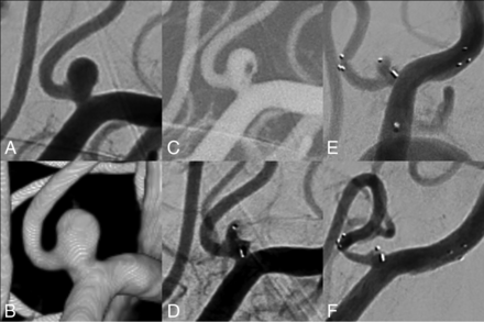 FIG 2.