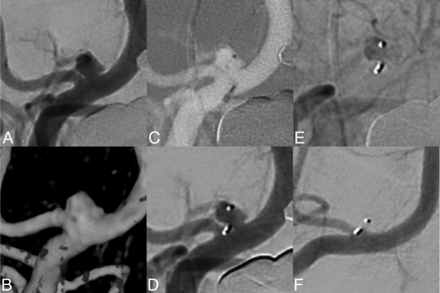 FIG 4.