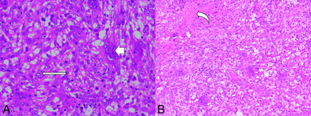 FIG 1.