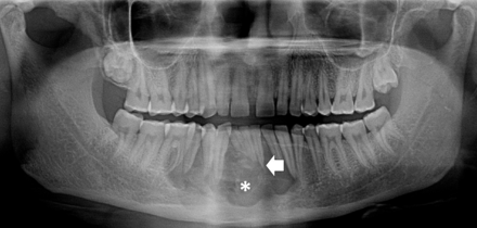 FIG 2.