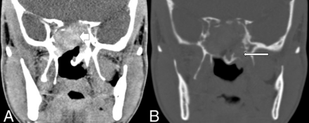 FIG 3.
