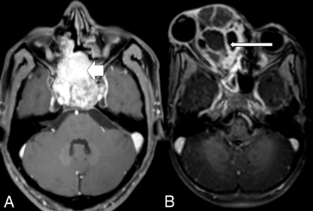 FIG 7.