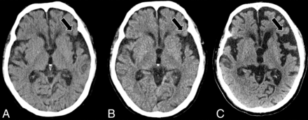 FIG 11.