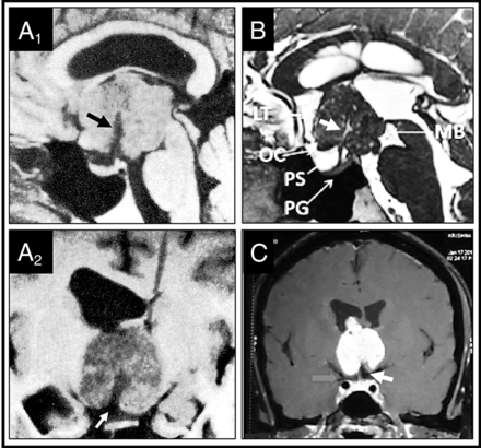 FIG 4.