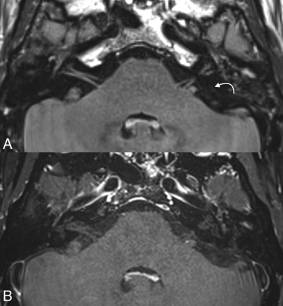 FIG 2.