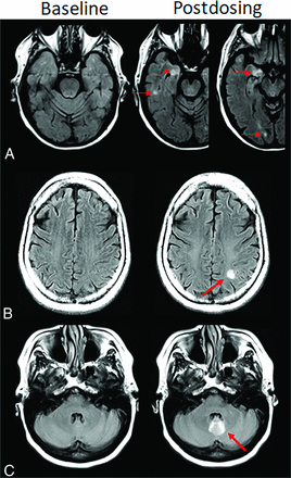FIG 4.