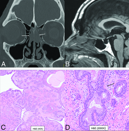 FIG 3.