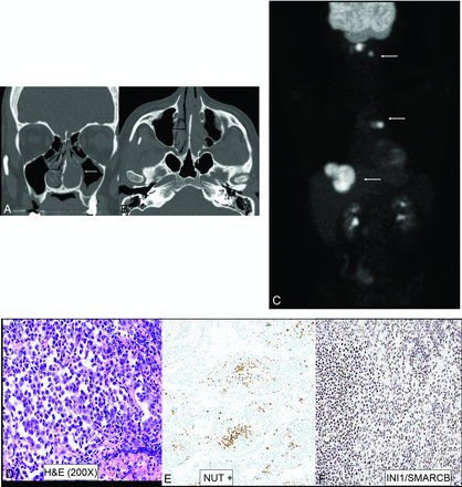 FIG 5.