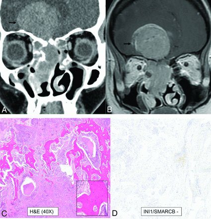 FIG 6.