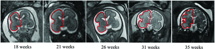 FIG 2.