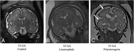 FIG 6.