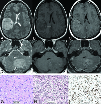 FIG 11.