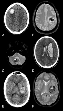 FIG 1.
