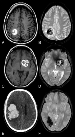 FIG 2.