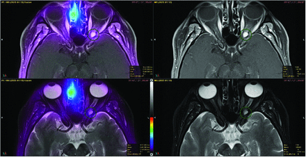 FIG 6.