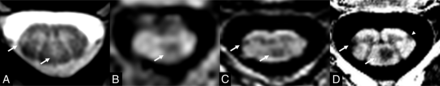 FIG 2.